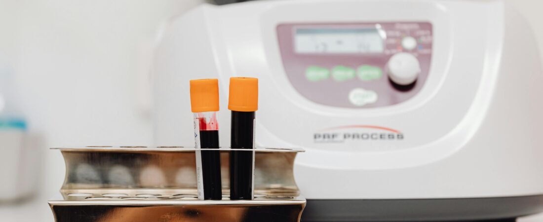 Now Offering Ultrasound-Guided PRP (Platelet-Rich Plasma) Injections