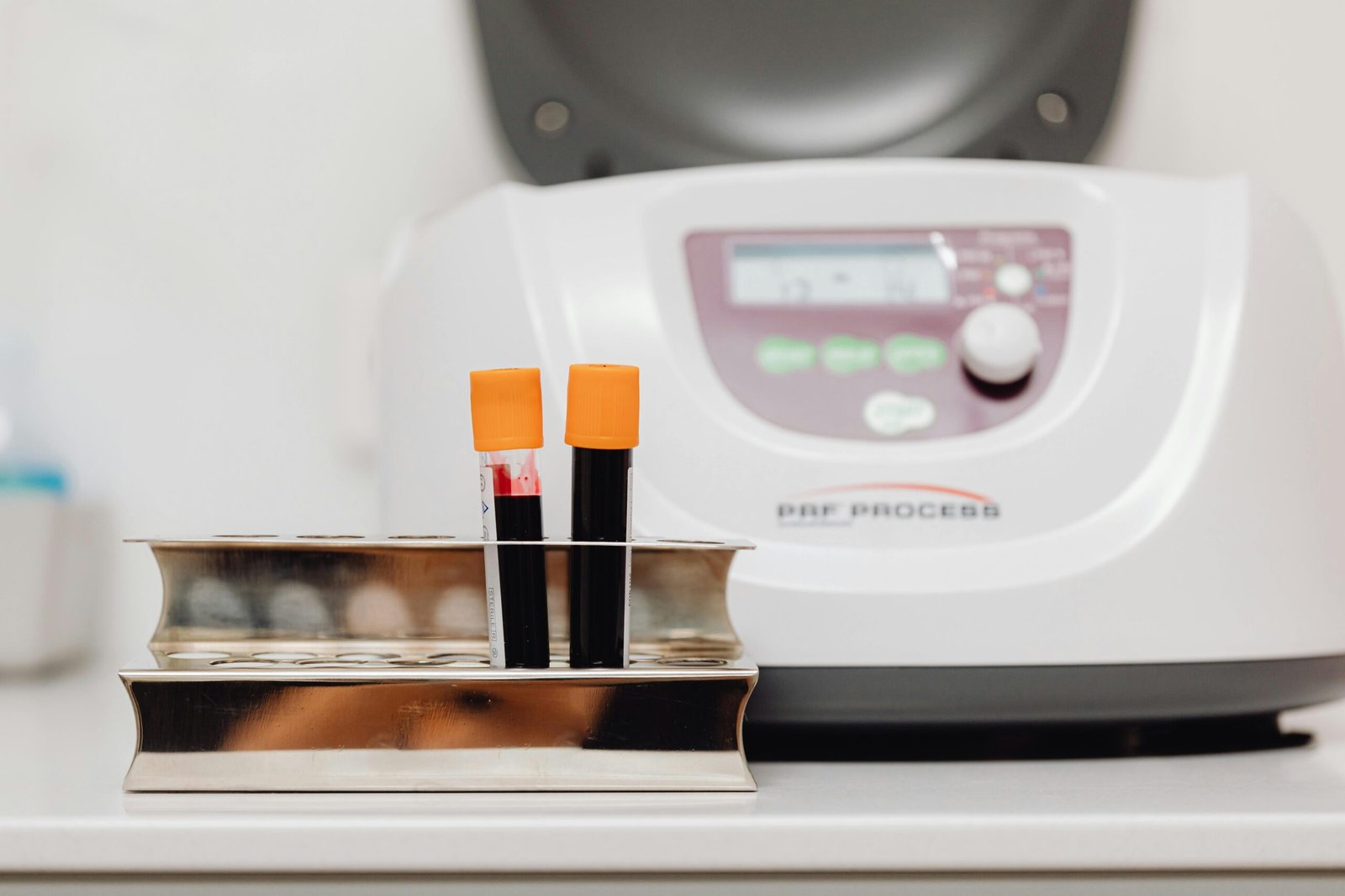 Now Offering Ultrasound-Guided PRP (Platelet-Rich Plasma) Injections